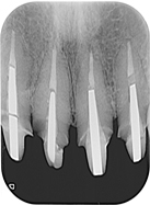 proimages/case/3D-02.png proimages/Case/dentalimplant/01/02/pic_case-04.jpg