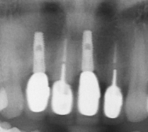 proimages/case/3D-02.png proimages/Case/dentalimplant/01/02/pic_case-10.jpg