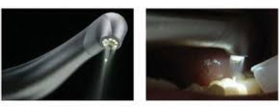 proimages/case/3D-01.png proimages/Case/dentalimplant/02/Laser01.jpg