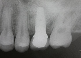 proimages/case/3D-01.png proimages/Case/dentalimplant/02/Laser04.jpg