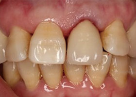 proimages/case/3D-01.png proimages/Case/dentalimplant/03/01/immeditaly10.jpg