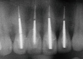 proimages/case/3D-01.png proimages/Case/dentalimplant/03/02/imed01.jpg