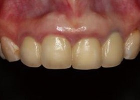 proimages/case/3D-01.png proimages/Case/dentalimplant/03/02/imed02.jpg