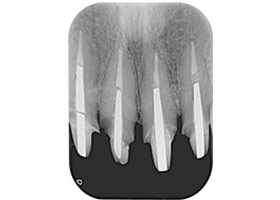 proimages/case/3D-01.png proimages/Case/dentalimplant/03/02/imed04.jpg