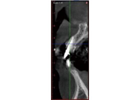 proimages/case/3D-01.png proimages/Case/dentalimplant/03/02/imed05.jpg