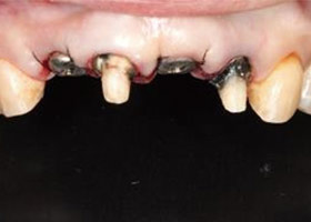 proimages/case/3D-01.png proimages/Case/dentalimplant/03/02/imed07.jpg