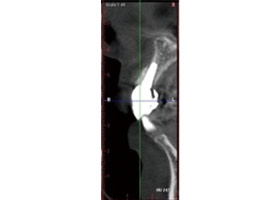 proimages/case/3D-01.png proimages/Case/dentalimplant/03/02/imed08.jpg