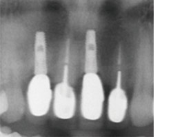 proimages/case/3D-01.png proimages/Case/dentalimplant/03/02/imed09.jpg