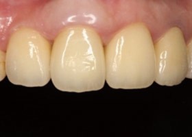 proimages/case/3D-01.png proimages/Case/dentalimplant/03/02/imed10.jpg