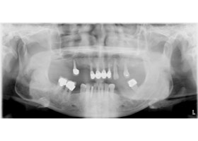 proimages/case/3D-01.png proimages/Case/dentalimplant/04/all-1.jpg