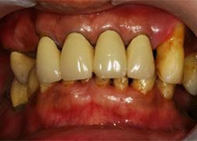 proimages/case/3D-01.png proimages/Case/dentalimplant/04/all-2.jpg