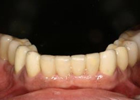 proimages/case/3D-01.png proimages/Case/dentalimplant/04/all-4.jpg