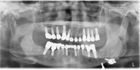 proimages/case/3D-01.png proimages/Case/dentalimplant/04/all-5.jpg
