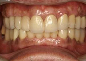 proimages/case/3D-01.png proimages/Case/dentalimplant/04/all-7.jpg
