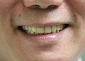 proimages/case/3D-01.png proimages/Case/dentalimplant/04/all-8.jpg