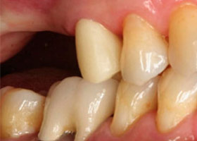 proimages/case/3D-01.png proimages/Case/dentalimplant/07/topcase01.jpg
