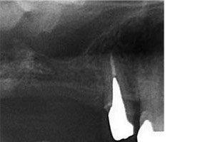 proimages/case/3D-01.png proimages/Case/dentalimplant/07/topcase02.jpg