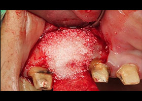 proimages/case/3D-01.png proimages/Case/dentalimplant/08/serious3.jpg