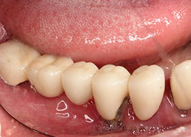 proimages/case/3D-01.png proimages/Case/dentalimplant/09/01/HON02-2.jpg