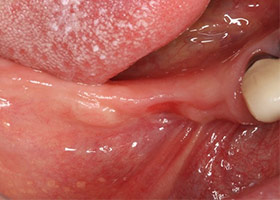 proimages/case/3D-01.png proimages/Case/dentalimplant/09/01/HON03-1.jpg