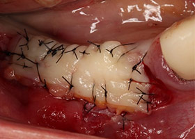 proimages/case/3D-01.png proimages/Case/dentalimplant/09/01/HON04-2.jpg