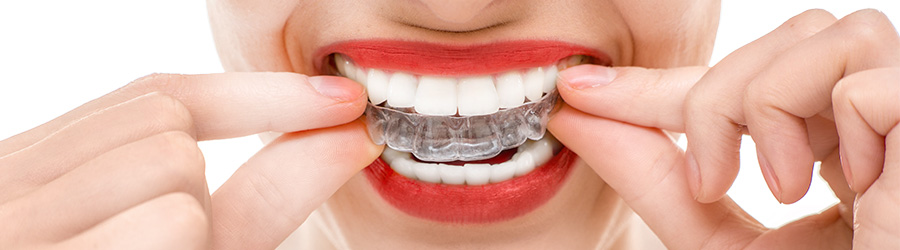 proimages/medical-item/smile/invisible-banner-06.jpg proimages/medical-item/smile/invisible-banner-06.jpg