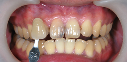 proimages/medical-item/smile/cold-case1.jpg proimages/medical-item/smile/cold-case1.jpg
