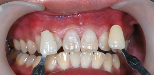 proimages/medical-item/smile/cold-case2.jpg proimages/medical-item/smile/cold-case2.jpg