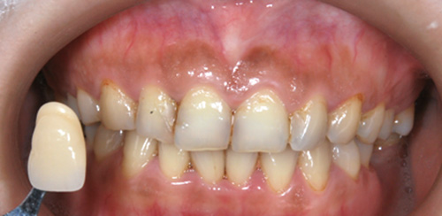 proimages/medical-item/smile/cold-case3.jpg proimages/medical-item/smile/cold-case3.jpg