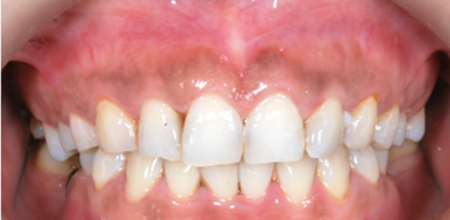 proimages/medical-item/smile/cold-case4.jpg proimages/medical-item/smile/cold-case4.jpg