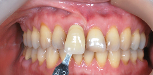 proimages/medical-item/smile/cold-case5.jpg proimages/medical-item/smile/cold-case5.jpg