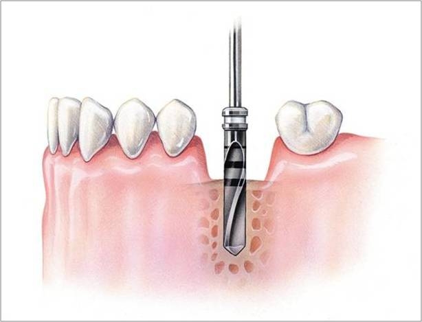 proimages/medical-item/process01.jpg proimages/medical-item/process01.jpg