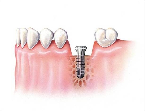 proimages/medical-item/process02.jpg proimages/medical-item/process02.jpg