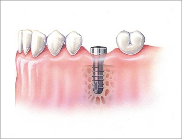 proimages/medical-item/process03.jpg proimages/medical-item/process03.jpg