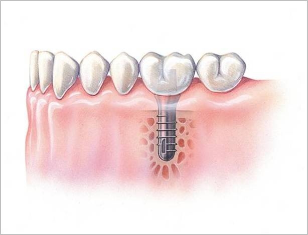 proimages/medical-item/process04.jpg proimages/medical-item/process04.jpg